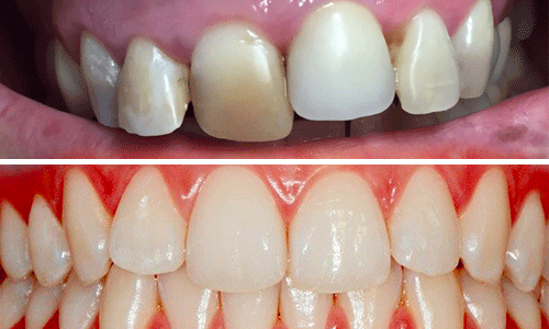 parodontologia oral beauty