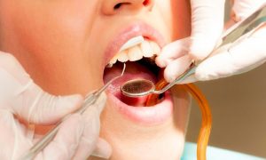 Endodonzia