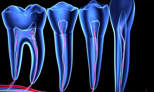 endodonzia