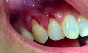 parodontologia oral beauty